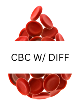 CBC w/ Diff